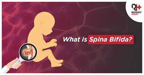 Spina bifida causes, symptoms and treatment